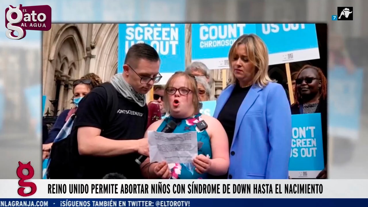 Reino Unido permite abortar niños con síndrome de Down hasta el nacimiento