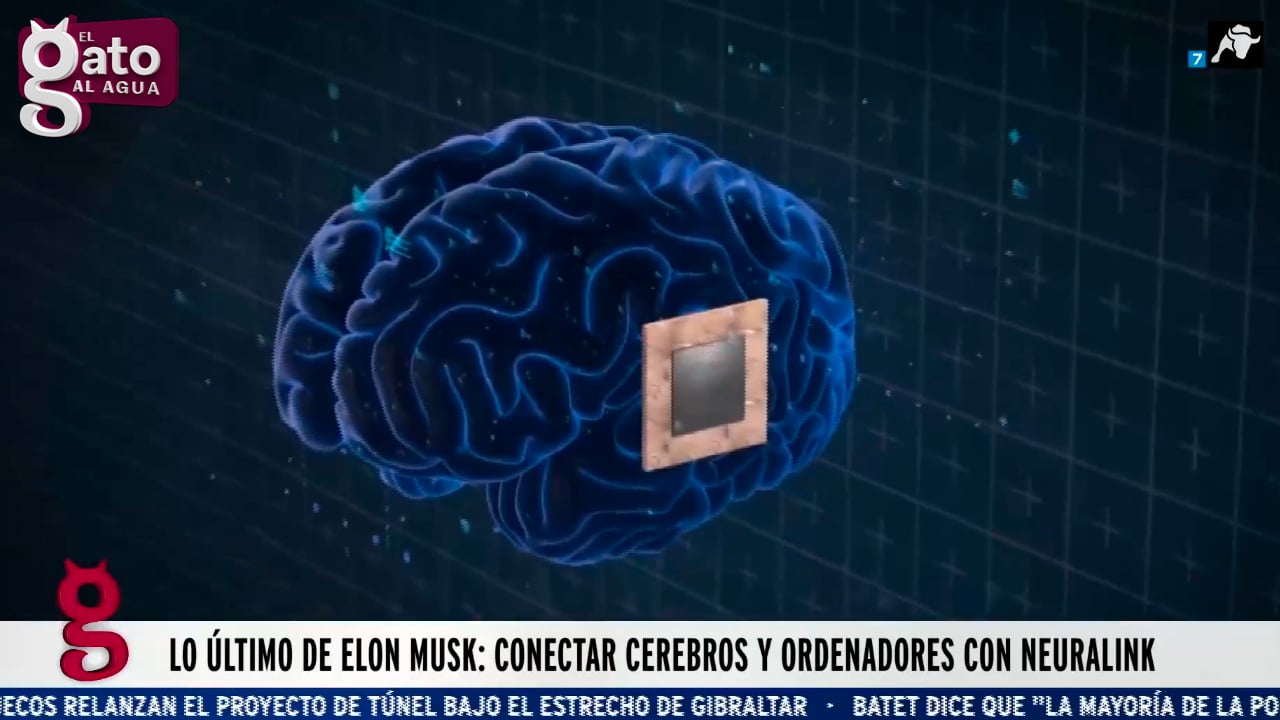 El Nuevo Proyecto De Elon Musk Implantar Chips En El Cerebro Humano El Toro Tv