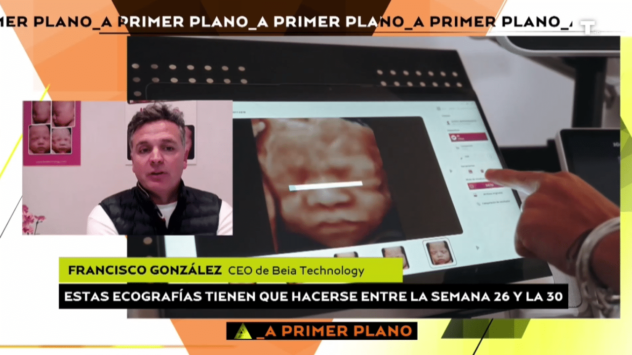 Se dispara la demanda de ecografías hiperrealistas con IA: «Está comprobado que se crea un vínculo beneficioso madre-hijo»