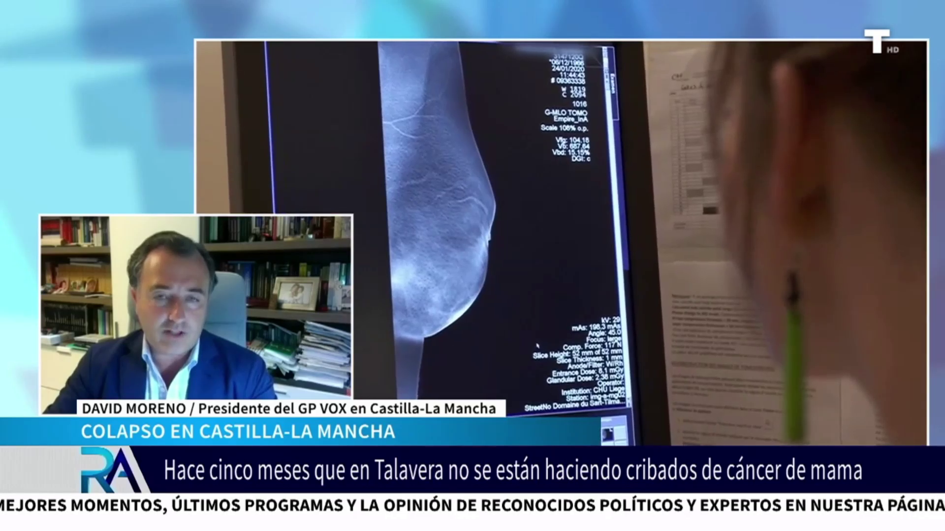 Escándalos sanitario en Castilla-La Mancha: 3.000 mujeres esperan resultados de cáncer de mama
