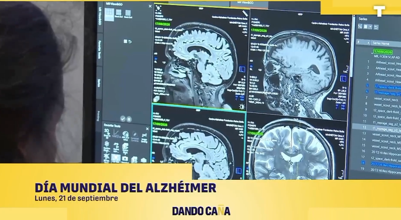 La ministra de Sanidad abandona a los enfermos de Alzhéimer